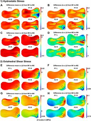 Frontiers Influence Of Tension Band Plates On The Mechanical Loading